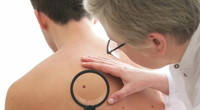 Dezembro Laranja Câncer de pele está cada vez mais presente entre os mais jovens, alerta oncologista