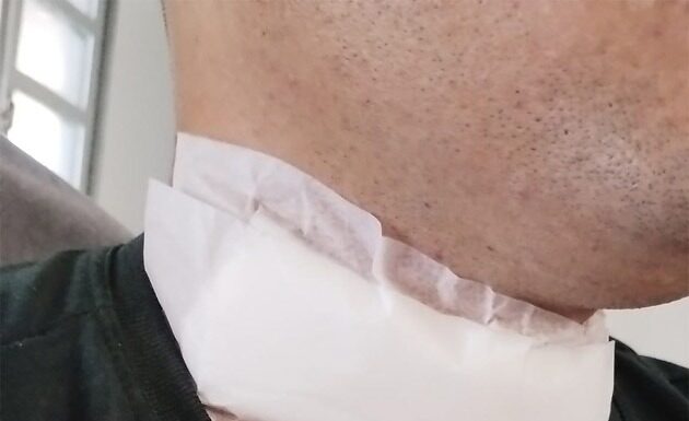 Homem fica ferido no pescoço por linha de pipa em Parapuã