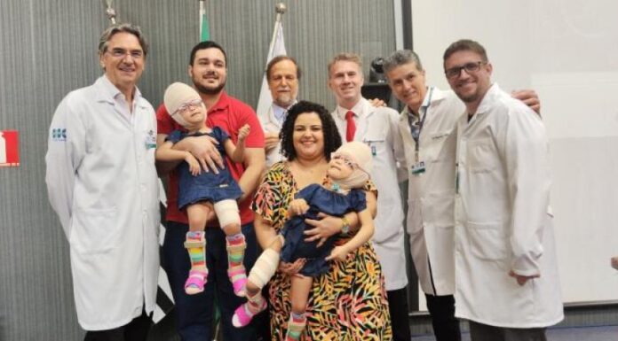 Após 12 meses de cirurgias, gêmeas siamesas separadas voltam para Piquerobi neste sábado
