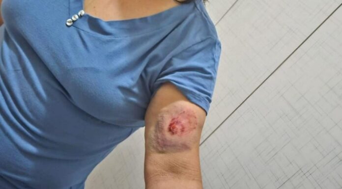 PROFESSORA FOI AGREDIDA POR ALUNO DIAGNOSTICADO COM TDAH e TOD