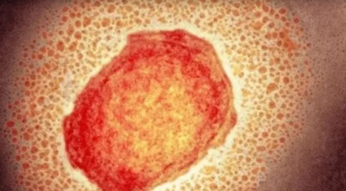 Grupo de Vigilância Epidemiológica de Presidente Prudente registra primeiro caso suspeito de monkeypox em 2024