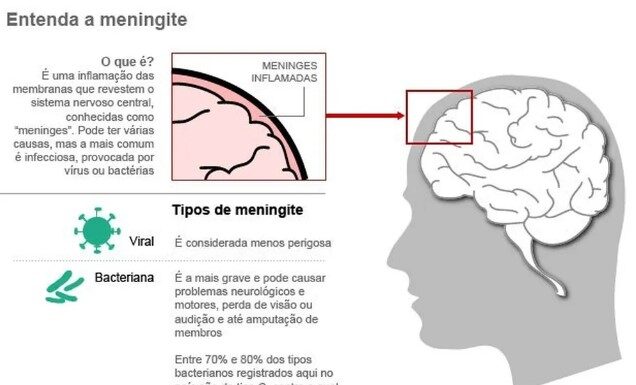 Secretaria de Saúde investiga morte de criança de oito anos por suspeita de meningite bacteriana em Osvaldo Cruz