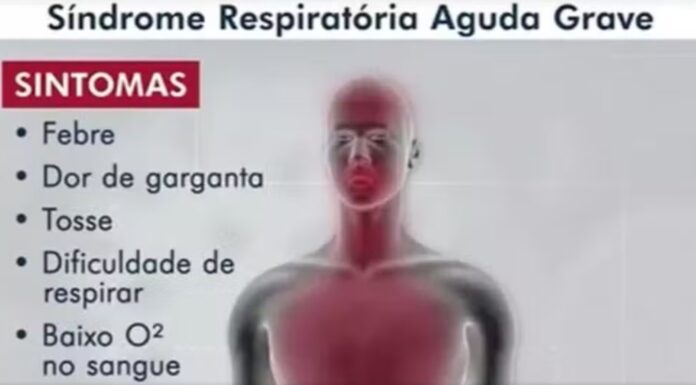 Casos de síndromes respiratórias graves disparam na região de Rio Preto
