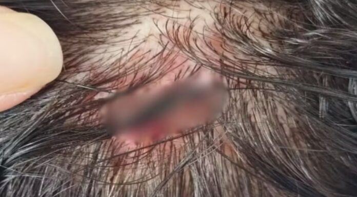 Homem é preso suspeito de morder e arrancar dedo de mulher em Auriflama