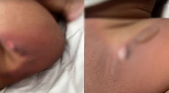 Bebê de 11 meses sofre queimaduras durante banho em creche de Jaú