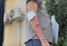 Idoso salvo por pitbull após ser agredido pelo filho cuida do animal todos os dias: ‘Um herói’, diz neto da vítima